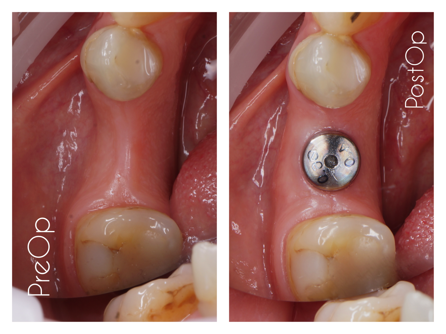 implantPro дентальная имплантация implantPro дентальная имплантация