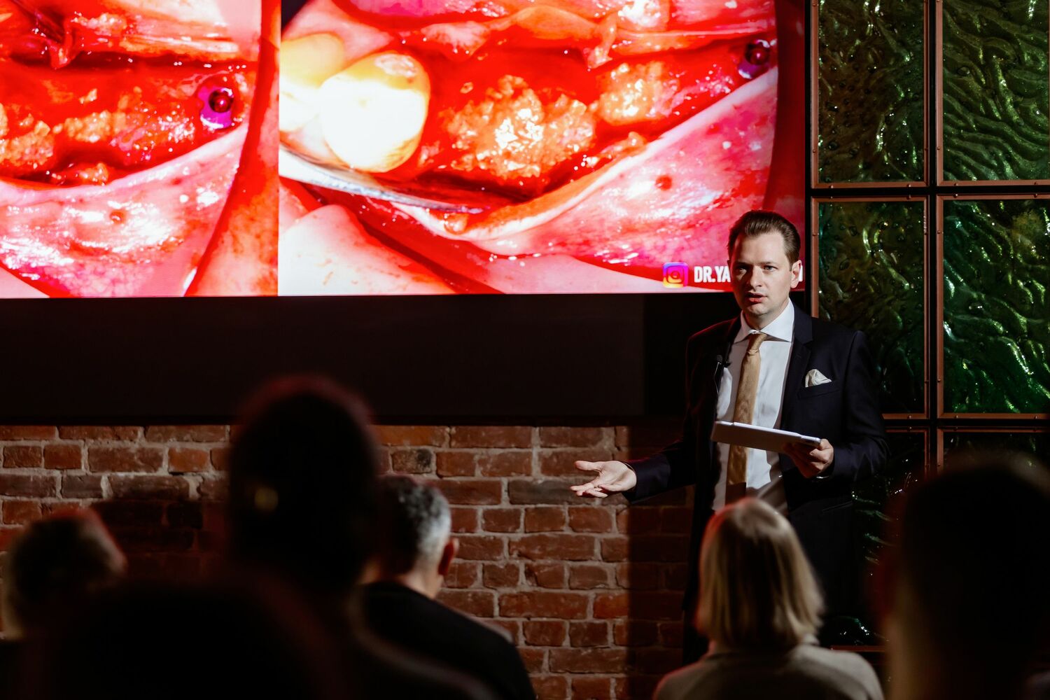 АКТУАЛЬНЫЕ ПРОТОКЛЫ ГОРИЗОНТАЛЬНОЙ И ВЕРТИКАЛЬНОЙ КОСТНОЙ ПЛАСТИКИ